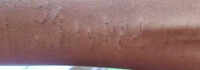 Chhattisgarh shocker: Mass wrist-cutting by 35 schoolkids, probe flags &lsquo;imitation' trend; Counsellors on job