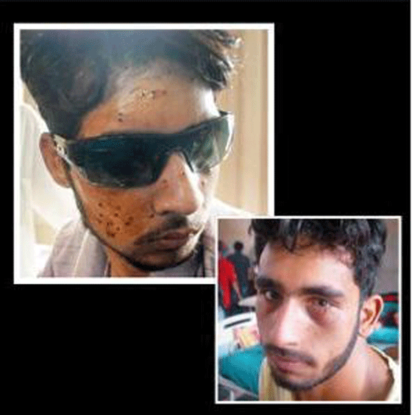 Pune doctors offer help in eye of Kashmir storm