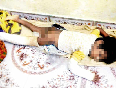 Neighbours rescue abused 4-yr-old boy from Vikhroli