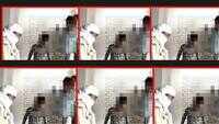 Shocking: Teen in UP given electric shocks, burned with molten wax over suspicion of theft 