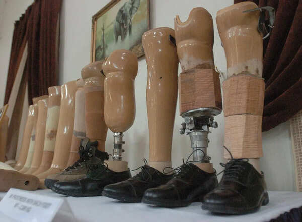 AFMS to transform Artificial Limb Centre into international rehab hub for amputees: DGAFMS