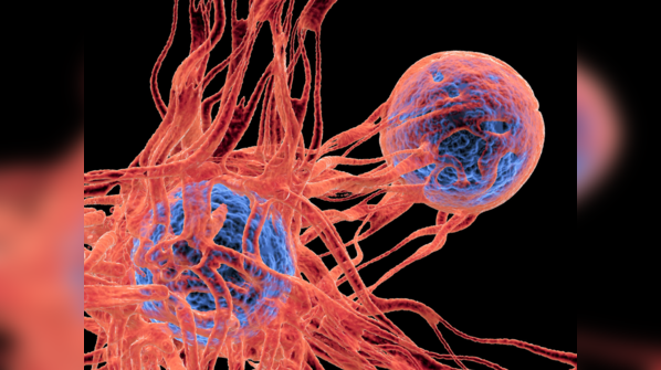 What is cancer?