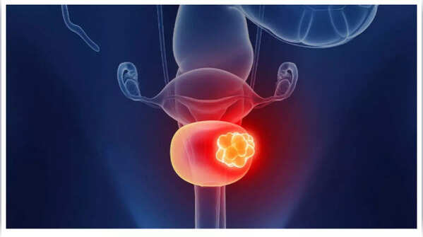 Lower back/pelvic pain