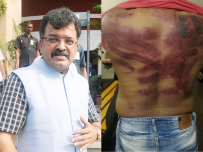 Civil Engineer allegedly took to Jitendra Awhad's bungalow by cops, brutally thrashed by minister's men for posting a morphed photo