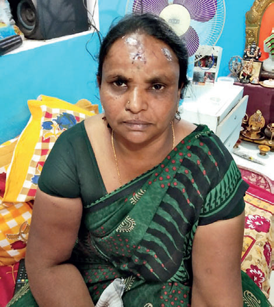 Bengaluru woman assaulted for complaining about pesky herd