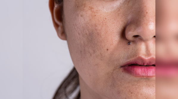 ​What is our Epidermis trying to tell us?