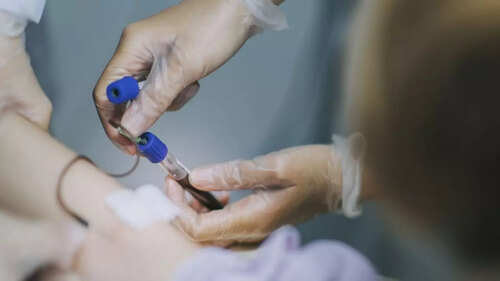 Head and neck cancer: How a simple blood test can detect cancer (up to 10  years ahead)