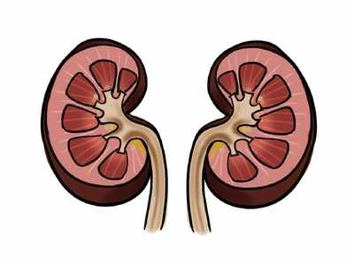 Kidneys weighing 7 kgs and 5.8 kgs removed from 41-year-old man at Mumbai hospital