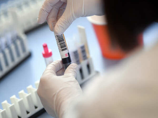 Kanpur: Private lab giving false report stopped from corona testing