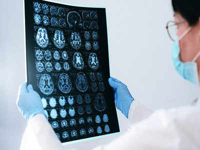 AI-enabled teleradiology pushes for faster scan reports
