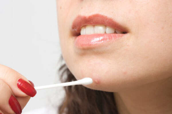 5 essential tips to stop breakouts