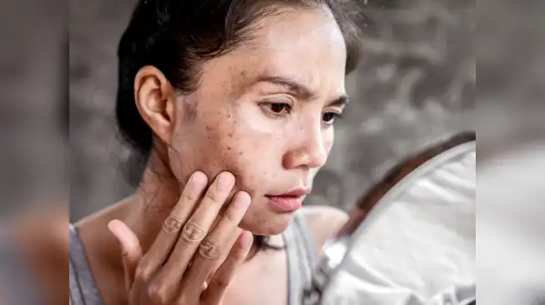 White spots on the skin