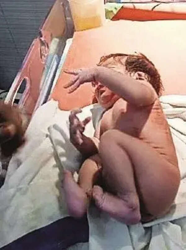 CM scheme saves life of Bathinda newborn