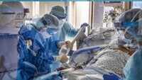Study reveals hospitalized COVID-19 patients have less comorbidity than flu patients 