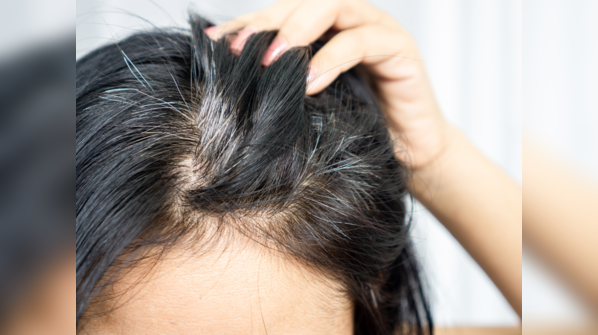 5 things to do now to prevent premature greying of hair