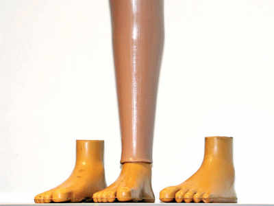 Jaipur Foot, low-cost prosthesis, is a mobility movement