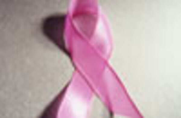 Regular breast screen programmes save lives 