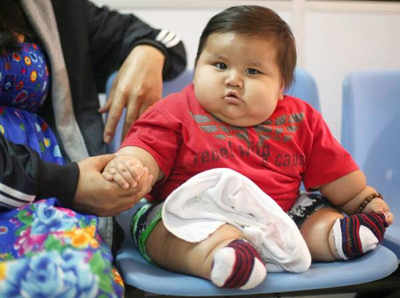 18-month-old boy weighs 22 kgs!