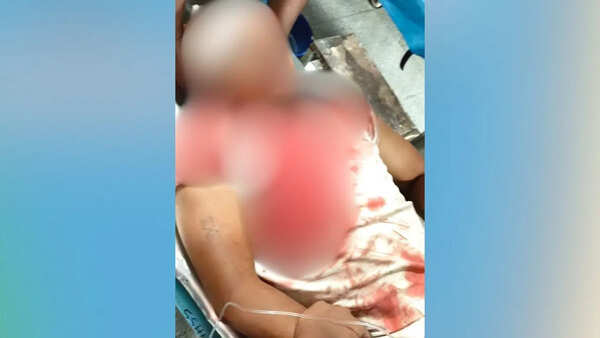BJP leader Pappu Sana assaulted with bamboo sticks in Bengal; critical