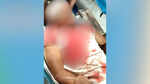 BJP leader Pappu Sana assaulted with bamboo sticks in Bengal; critical