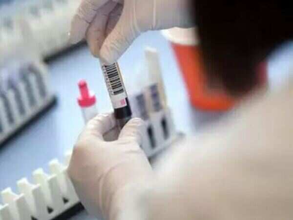Covid-19: Activist raises questions over rapid testing kits