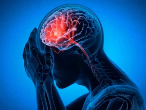 State plan to get KEM docs to remotely operate on stroke patients in rural Maha