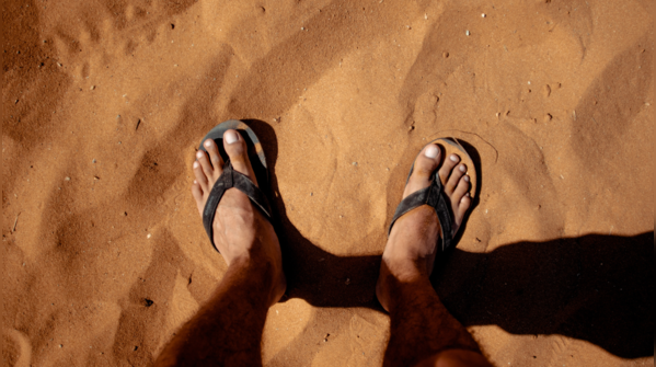 Hot or burning feet