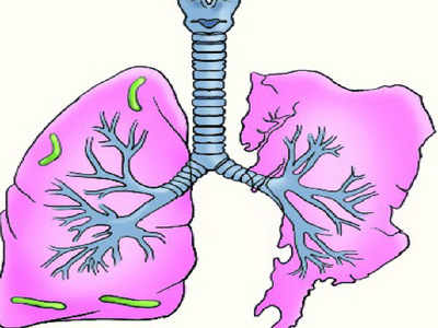 Don’t avoid changes in symptoms of chronic lung disease, says Indian Chest Society