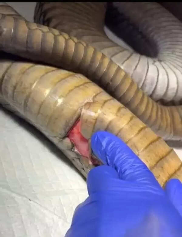 King cobra treated after deep abdominal injury