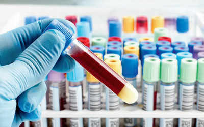 Storage time of biobank affects blood test results