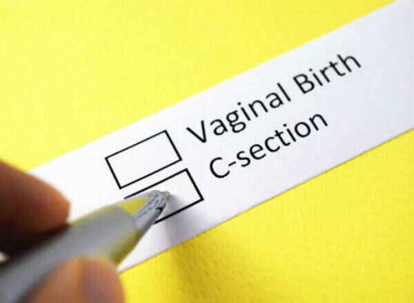 Myths about Caesarean deliveries busted
