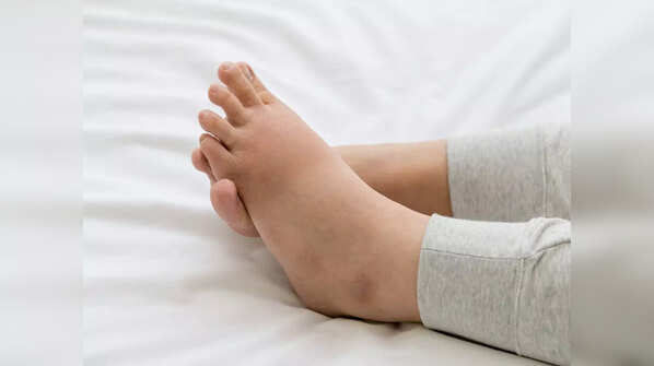 Swelling and pain in your foot
