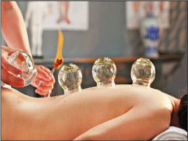 Indians try cupping as Phelps boosts this pain relieving technique