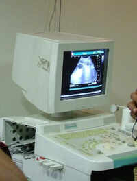 Ban apps aiding in detection of sex of fetus: Civil surgeon writes to state govt
