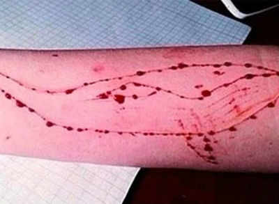 The Blue Whale Challenge: Everything you need to know about the 'deadly' game
