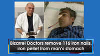 Bizarre! Doctors remove 116 iron nails, iron pellet from man’s stomach in Rajasthan 