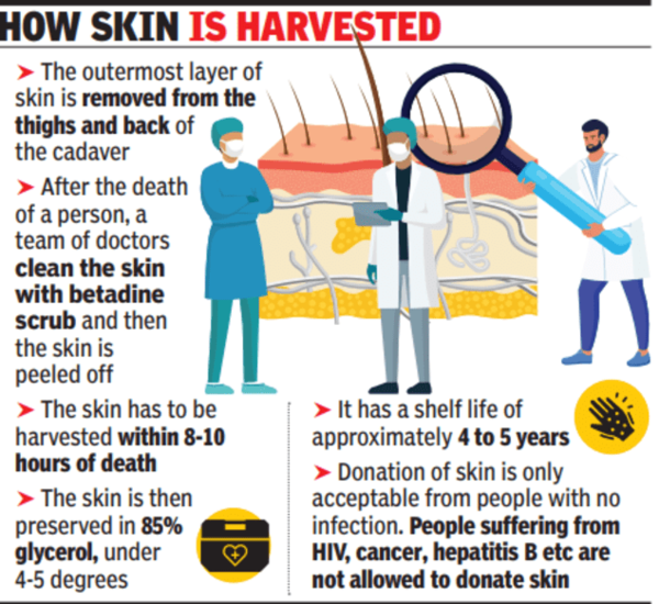 Skin_bank_Safdarjung _hospital