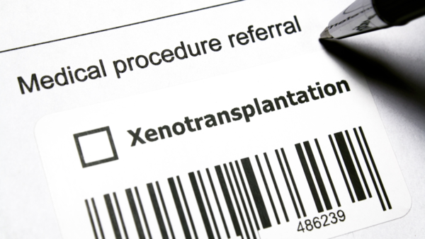 xenotransplantation