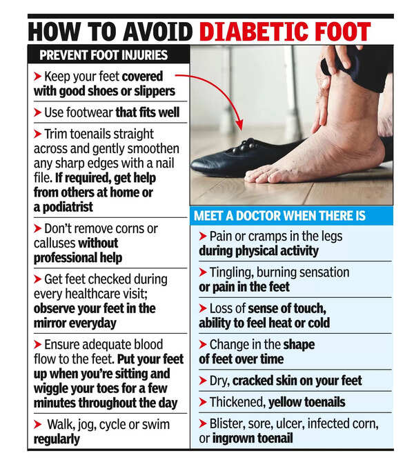 Foot Legup Govt Hospitals To Start Diabetic Foot Clinics Chennai