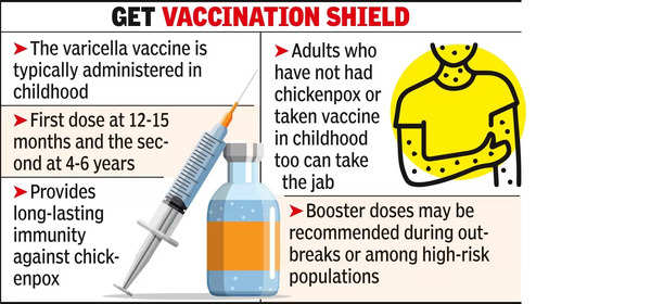 Chickenpox Again Raising Head In City, Stay Vigilant | Nagpur News – Times of India