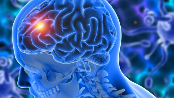 brain (2)
