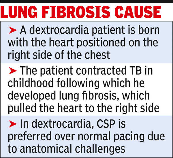 Cardiac Procedure: Man with heart on right side undergoes rare cardiac ...