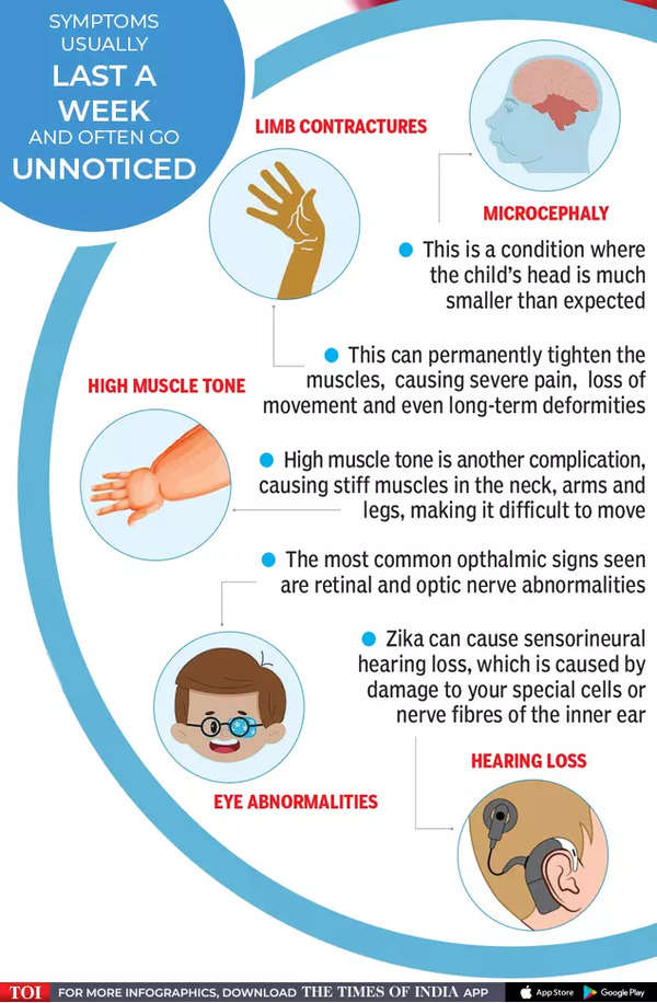 Decoding Zika Virus: Symptoms, Precautions, Expert Advice, All You Need 