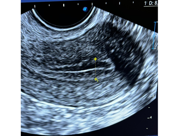 Celebrating World IVF Day: Innovations and Breakthroughs in Fertility ...