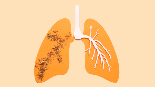 Lung cancer