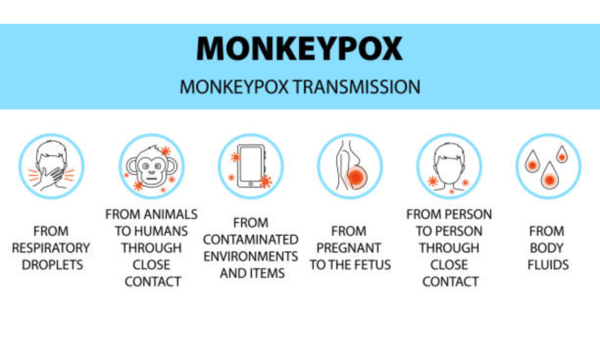 Monkeypox can unfold like COVID thru shut touch: How this is able to put Indians in peril all the way through upcoming festive season and the way to keep protected? | – Instances of India