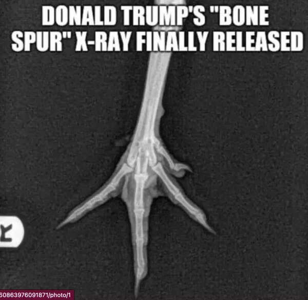 Trump x-ray meme