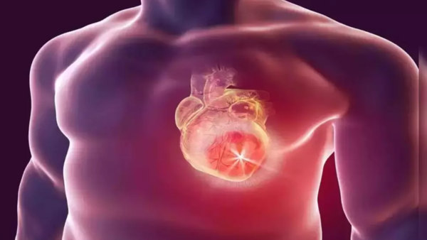 India's Heart Health Crisis: Cardiologists Discusses Common Ailments ...