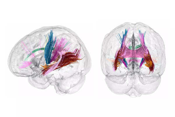 ¿Cómo cambia el embarazo el cerebro? Surgen pistas.