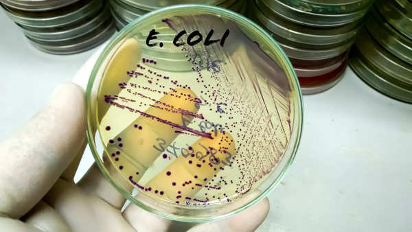 ecoli